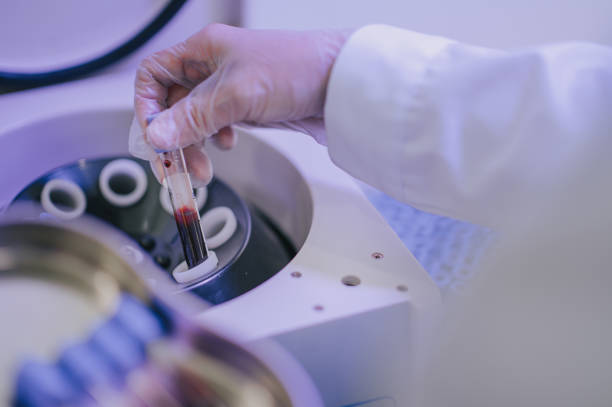 nurse working on platelet-rich-plasma therapy using centrifuge machine